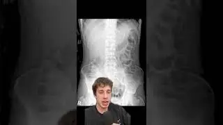 DUMBEST WAYS people have EVER DIED pt.2 