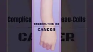 Mémo - Complications de la fracture type Pouteau-Colls