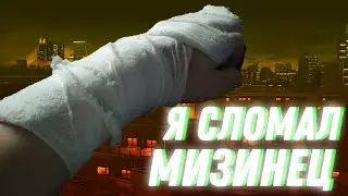 Я СЛОМАЛ МИЗИНЕЦ 😱