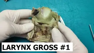 Larynx gross #1