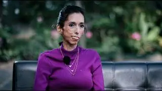 Incluyeme Argentina - Historias de Inclusión  Perú  2023 - #producciónaudiovisual