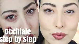 HOW TO COVER DARK CIRCLES AND UNDER-EYE BAGS | STEP-BY-STEP CONCEALER