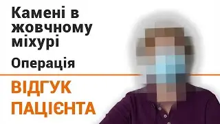 Камни в желчном пузыре (лечение) - отзыв пациентки клиники 