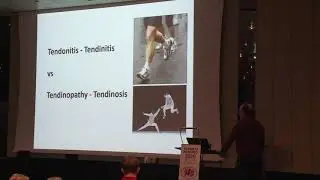 #Sportskongres 2020 - How inflamed is the tendinopathic tendon?