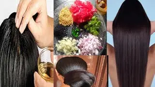 Stop Hair Fall in 1 week - Thick long Hair in 15 day| झरते बाल गंजे सर से मुक्ति | kamaliaslifestyle