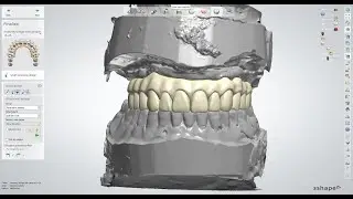 3Shape Design Service - Simple Upload Workflow