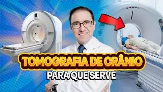 Tomografia do Crânio: Indicações e Como é Realizada