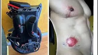 Death Wobble Crash on my Begode ET MAX!🥴