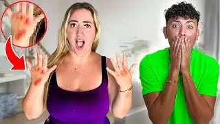 SHE GOT AN ALLERGIC REACTION...