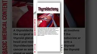 Thyroidectomy 