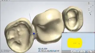 How to Design Bridge Connectors and Anatomical Copings with 3Shape Dental System