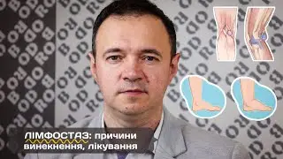 А ви знали, що є справвжньою причиною набряків на ногах. Дивіться до кінця