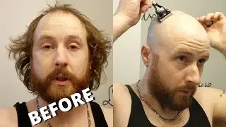 HEAVILY BALDING To Razor Head Shave BALD in 1 Go + My Thoughts