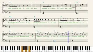Imagine Dragons — Bones Piano Sheet Music