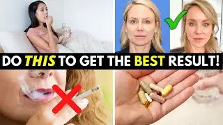 5 Things you MUST do to prepare for your Facelift Surgery!