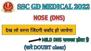 SSC GD DNS MEDICAL | Ssc Gd Nose Medical |Ssc gd medical video | Ssc Gd Me Nose Kaise Check Hota Hai