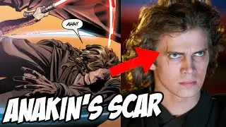 How Anakin Skywalker got his scar… (Star Wars Explained)