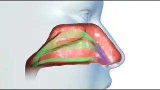 VivAer: Inside The Non-Surgical Procedure To Help Nasal Congestion
