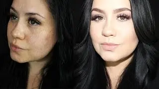 How I Conceal My Dark Spots & Acne Scars