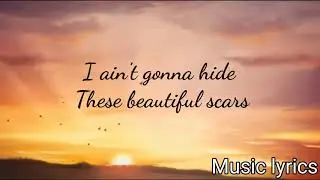 Beautiful scars - Maximillian