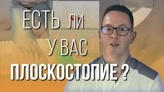 4 признака плоскостопия – как определить самостоятельно