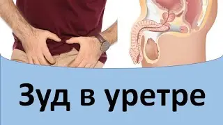 Зуд в уретре