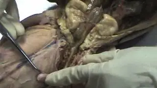 Abdominopelvic Cavity part 1
