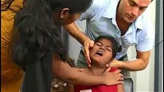 Dr. Ian - Day 2 Volunteer Work India - LOSS of Hand Control from HEAD INJURY - Gonstead Chiropractic
