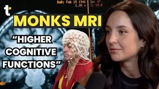BRAIN EXPERT REVEALS ALL 