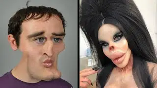 10 Unusual People Who Took Plastic Surgery Too Far...