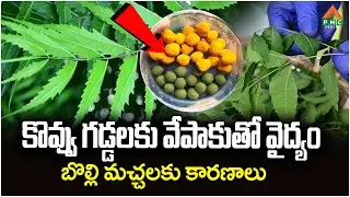 కొవ్వు గడ్డలకు వేపాకుతో వైద్యం | PMC Health