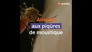 Allergie aux piqûres de moustique : comment se soigner ?