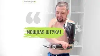 «Мощная штука». Протез руки после минно-взрывной травмы