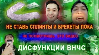 НЕ СТАВЬ СПЛИНТ И БРЕКЕТЫ ПОКА НЕ ПОСМОТРИШЬ ЭТО ВИДЕО (часть1)