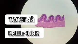 LARGE INTESTINE