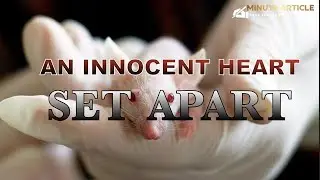 Odd Story - Organ transplant - organ harvesting - heart transplant - Xenotransplantation