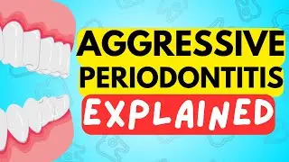 AGGRESSIVE PERIODONTITIS EXPLAINED IN 5 MINUTES - CAUSE, DIAGNOSIS, RISK FACTORS AND TREATMENT