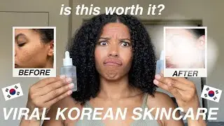 I used VIRAL KOREAN VITAMIN SKINCARE FOR 3 MONTHS ft. #numbuzin