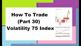 How To Trade (Part 30) *Volatility 75 Index