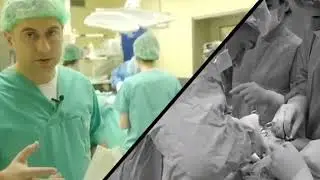 Sadiq BEBİROV Qalxanvari vezi emeliyyati