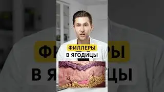 НЕ вводите филлеры в ягодицы!
