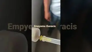 #empyemathoracis