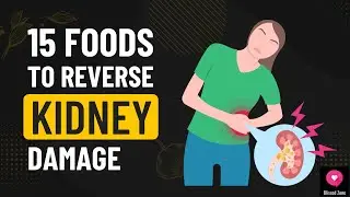 15 Foods To Reverse Kidney Damage | #kidneyhealth | Blissedzone
