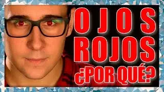 Por qué OJOS ROJOS en nuestras fotos