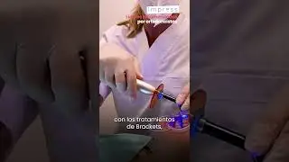 ¿Qué son los ENGAGERS EN ORTODONCIA INVISIBLE?🤔 ¡El Dr. Ariel te lo cuenta todo!
