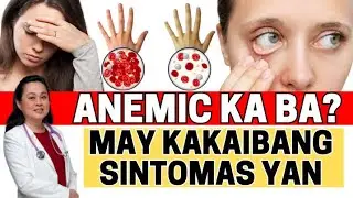 Anemic Ka Ba? May Kakaibang Sintomas Yan. - By Doc Liza Ramoso-Ong