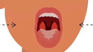 سوء رائحة الفم او البخر لماذا يحدث وكيف نتخلص منه ؟