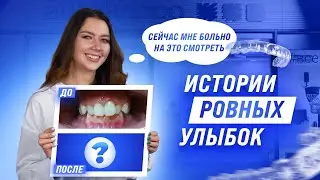 Истории ровных улыбок | Лечение на элайнерах EUROKAPPA