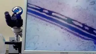Гистология Органы зрения и слуха