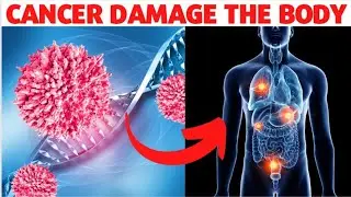 How can Cancer Damage the Body?